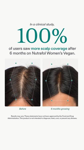 A high-contrast before-and-after comparison showing scalp coverage results from a clinical study for a vegan hair growth supplement.